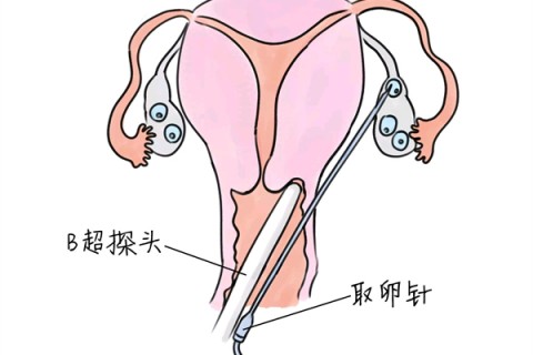 http://hangzhou.vdtfzz.com/post/205.html|杭州供卵助孕